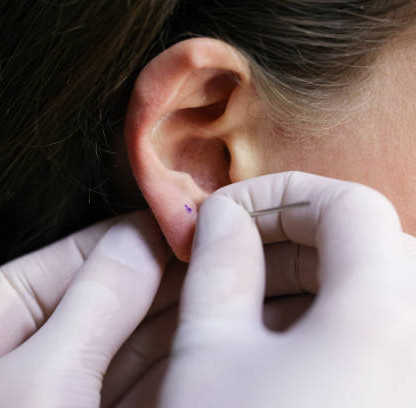 Piercing aiguille ou pistolet : lequel choisir ?
